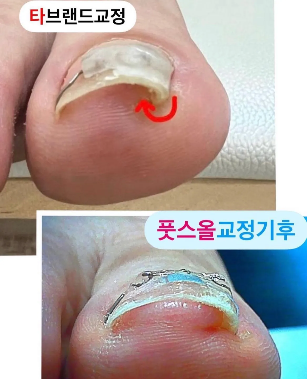 이미지 6