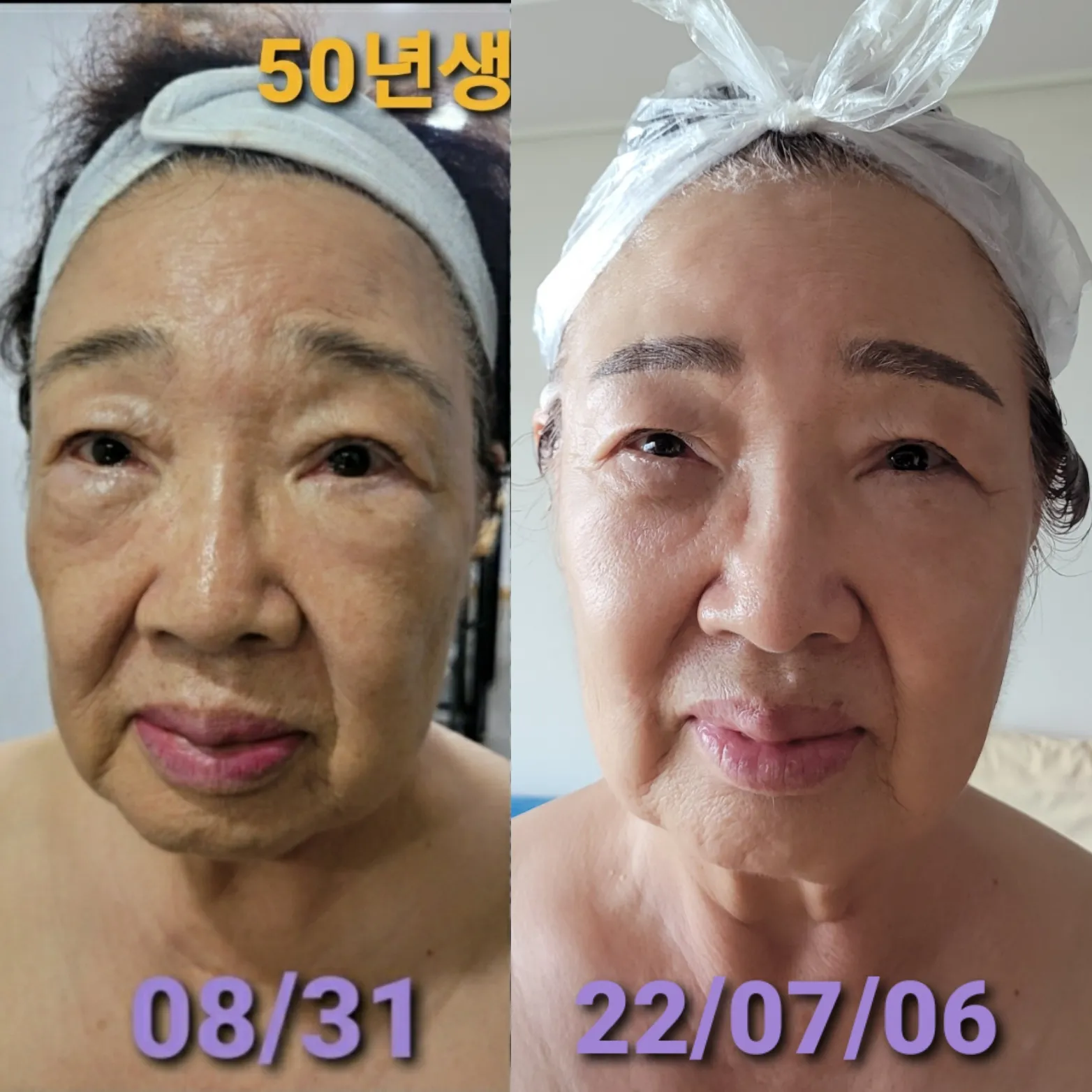 이미지 10