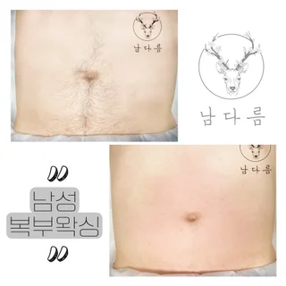 복부왁싱