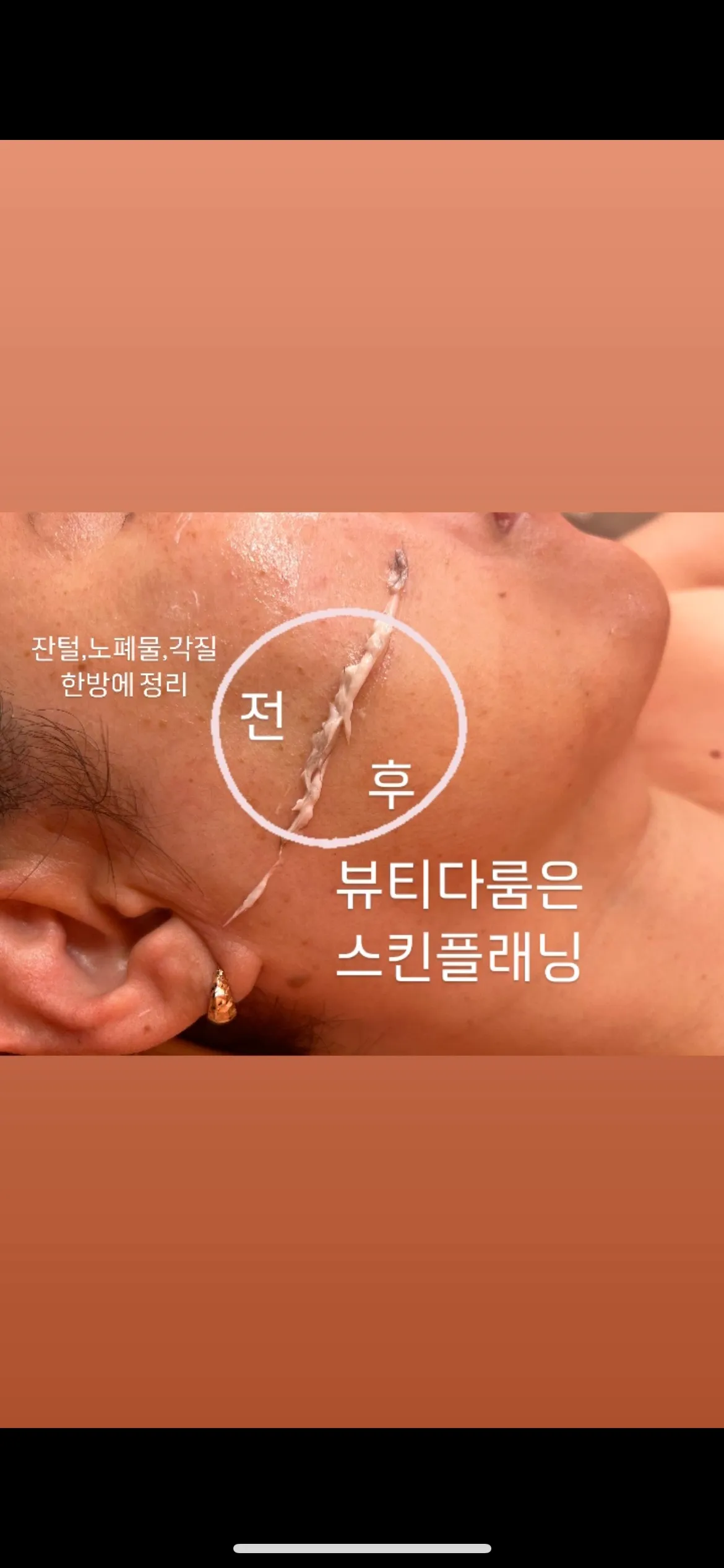 이미지 11