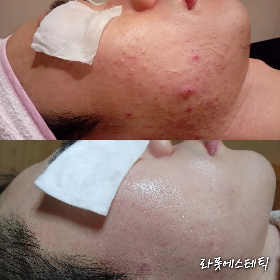 이미지 8