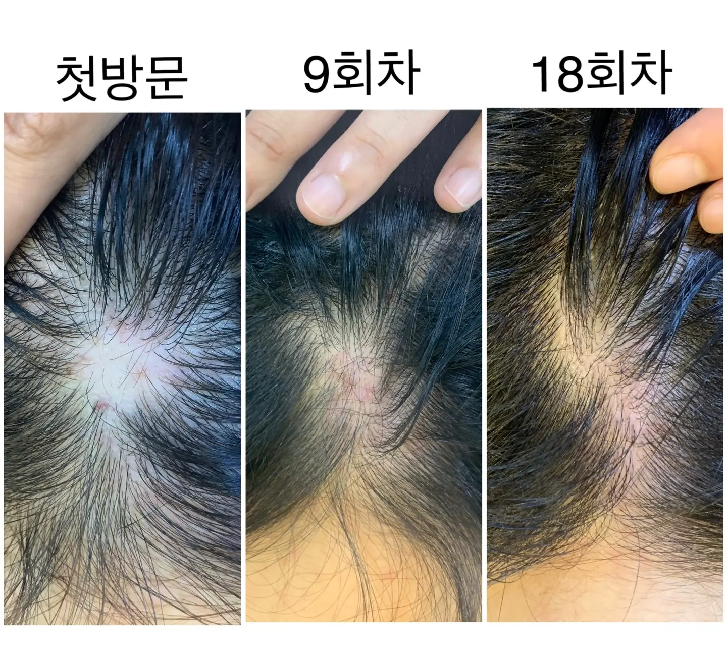 이미지 5