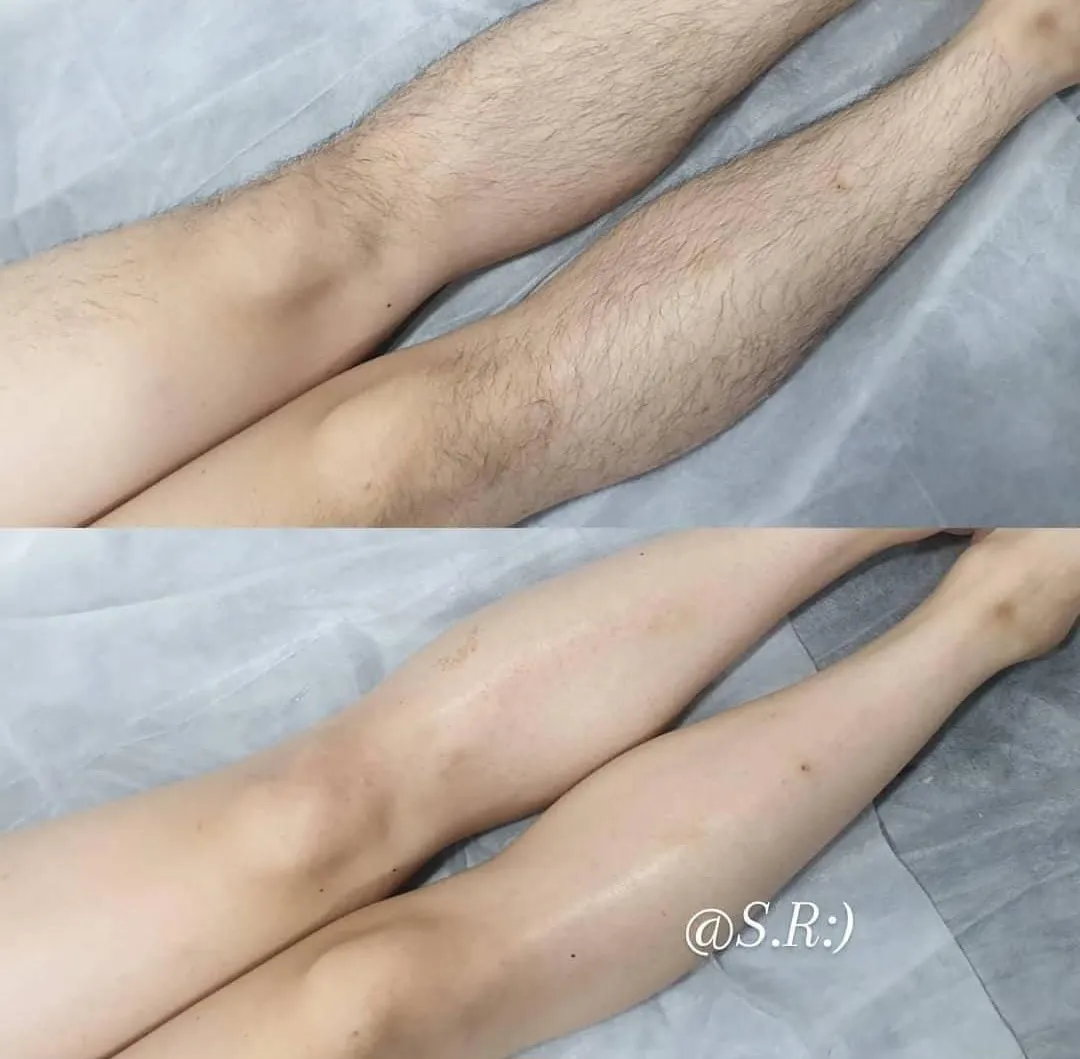 이미지 2