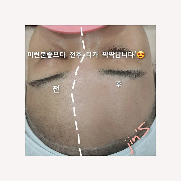 이미지 9