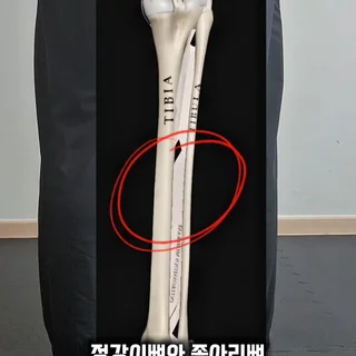 달릴 때 정강이 통증, 발목 탄성 강화로 해결하는 퍼스널 트레이닝