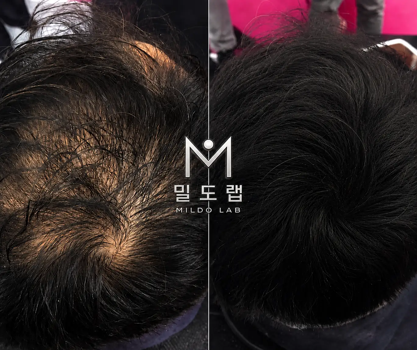이미지 28