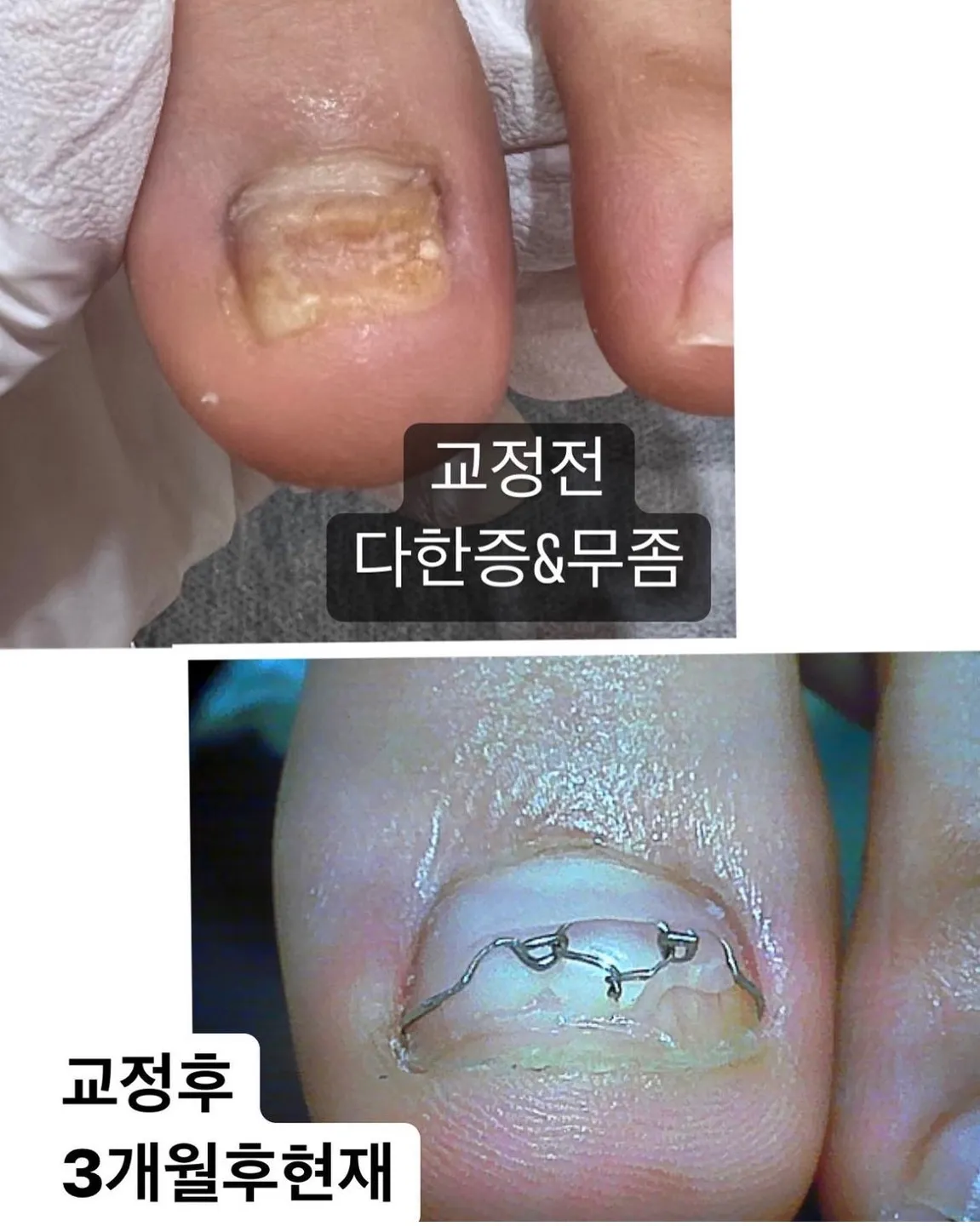 이미지 8