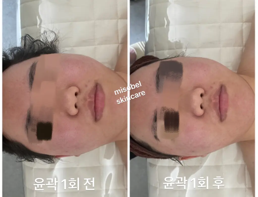 이미지 5