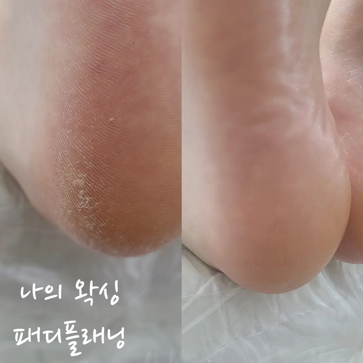 이미지 7