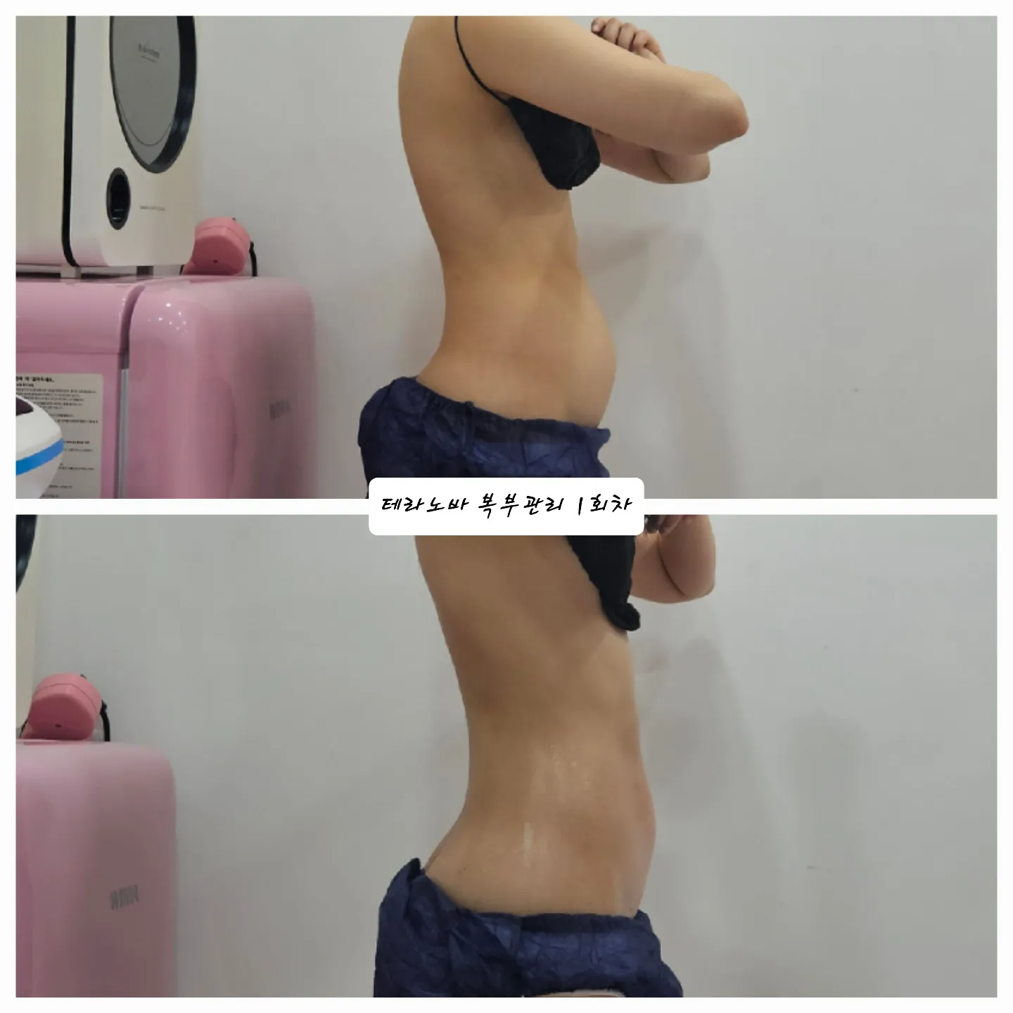 이미지 2