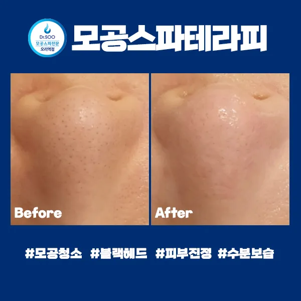 이미지 5