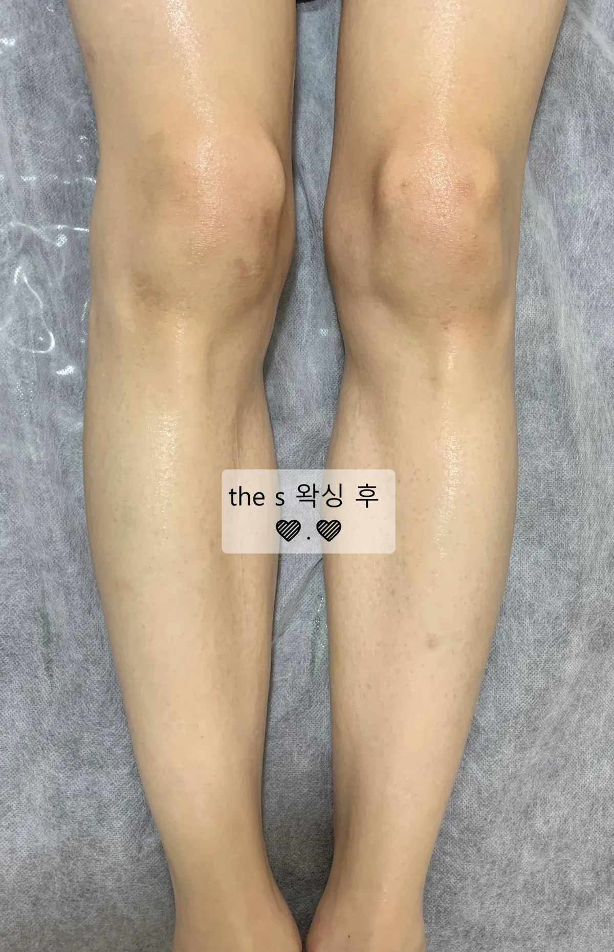 이미지 8