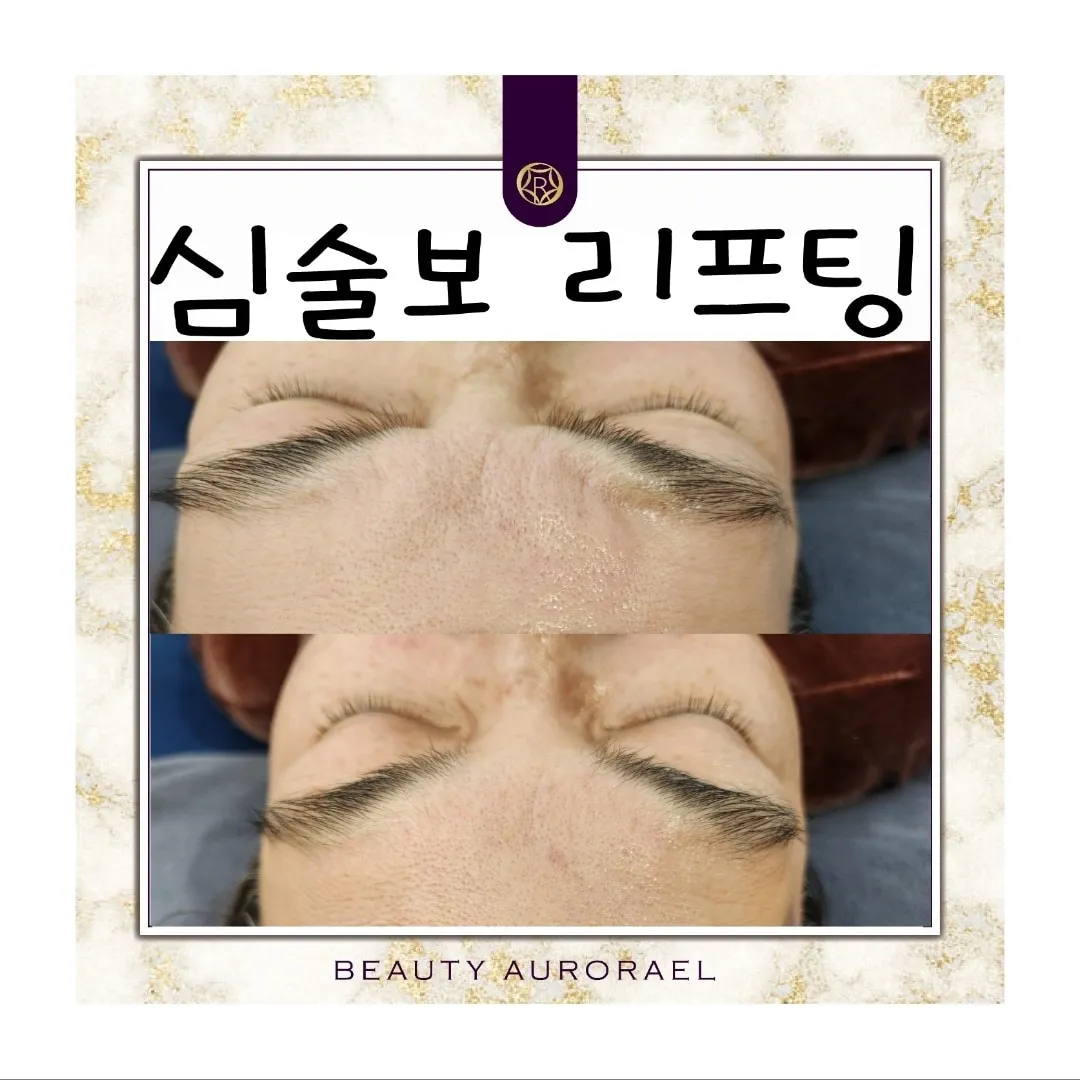 이미지 5