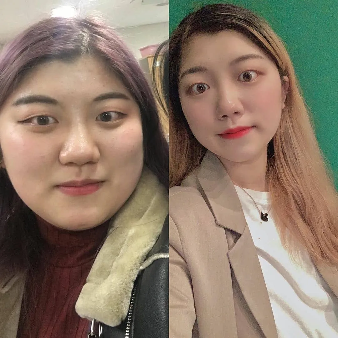 이미지 5