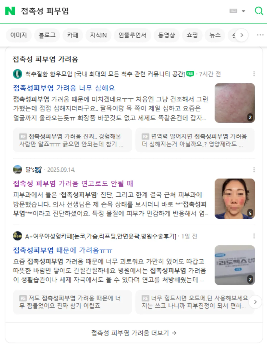 포트폴리오 이미지