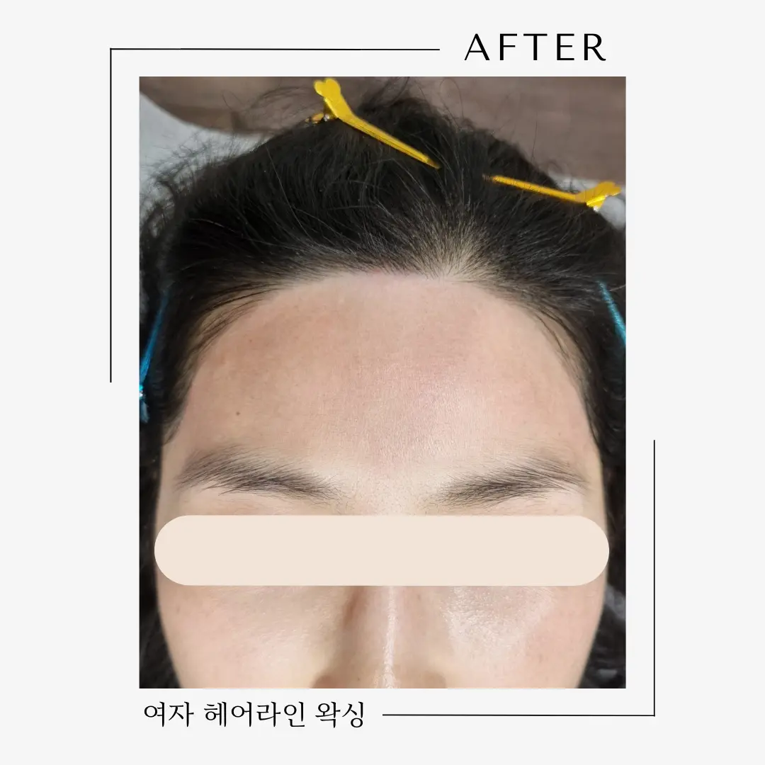 이미지 5