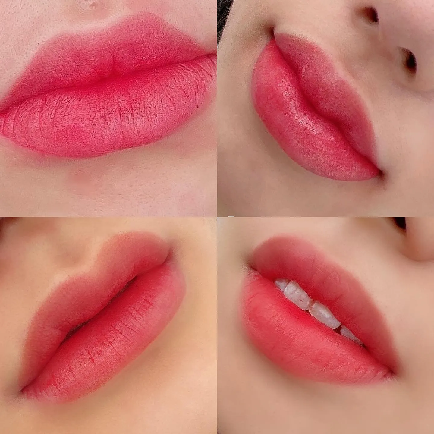 이미지 3