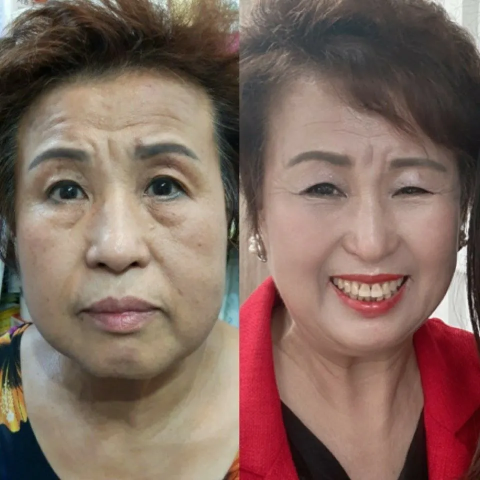 이미지 5