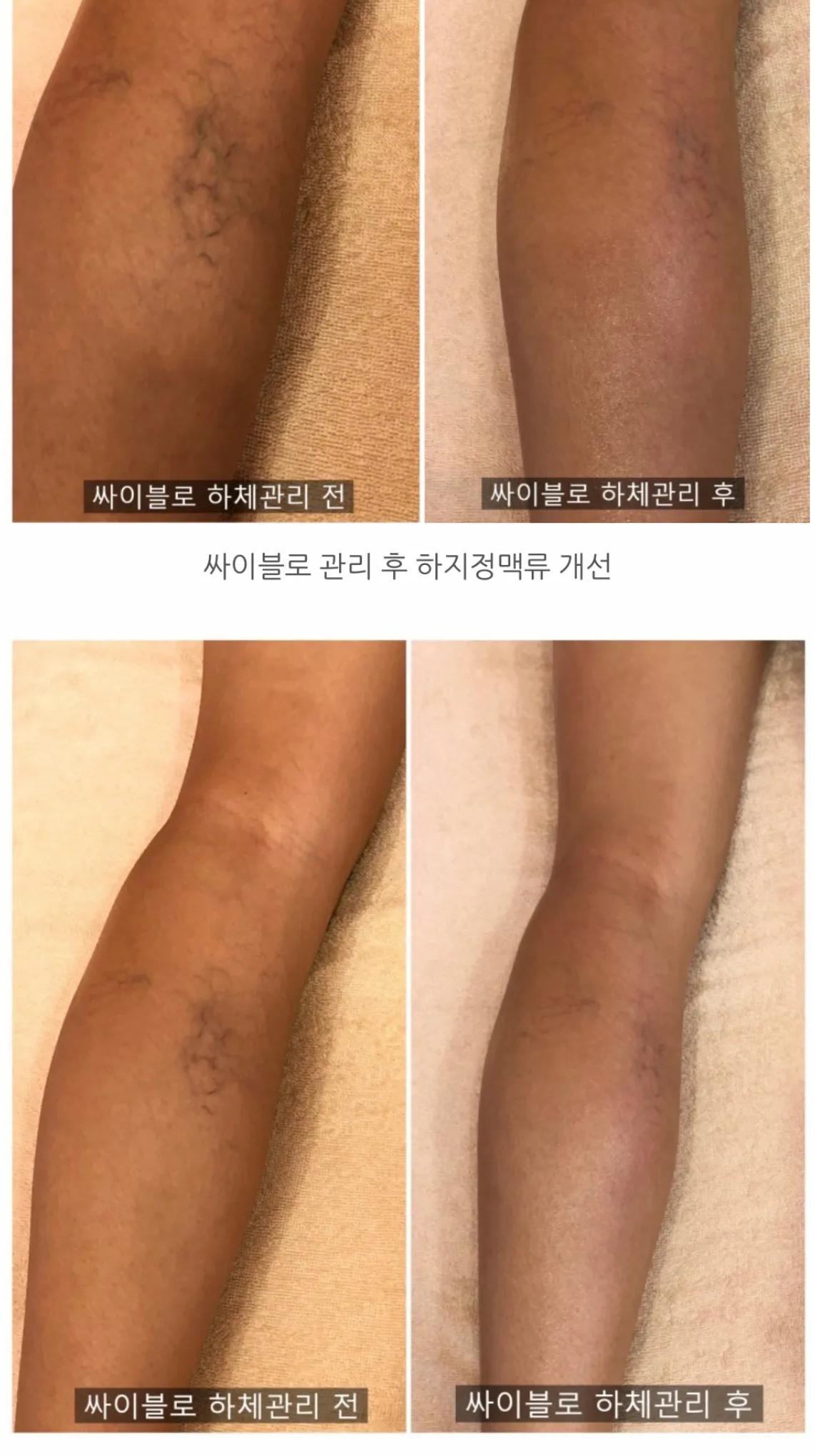 이미지 4