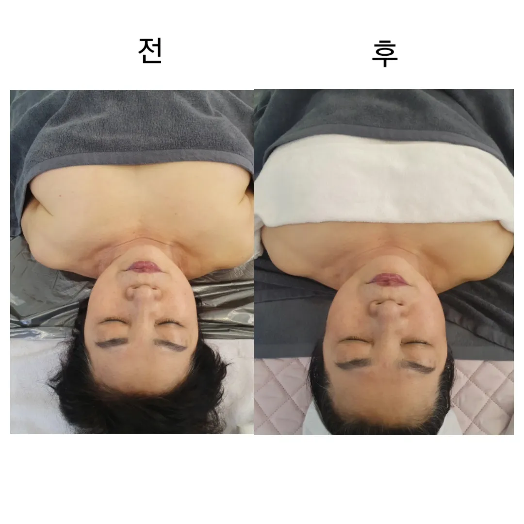 이미지 9