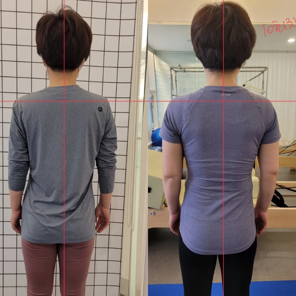 이미지 5