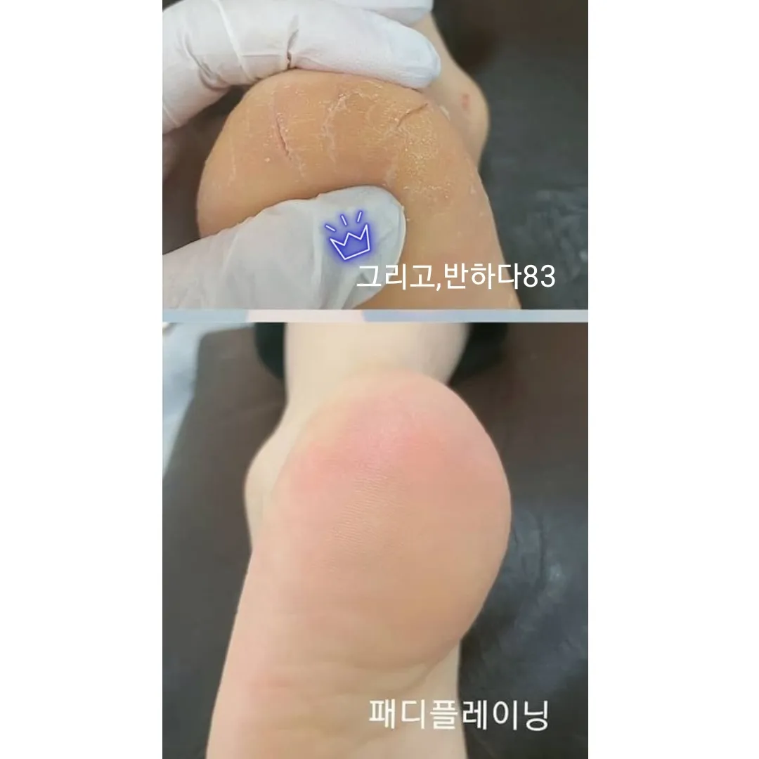 이미지 10