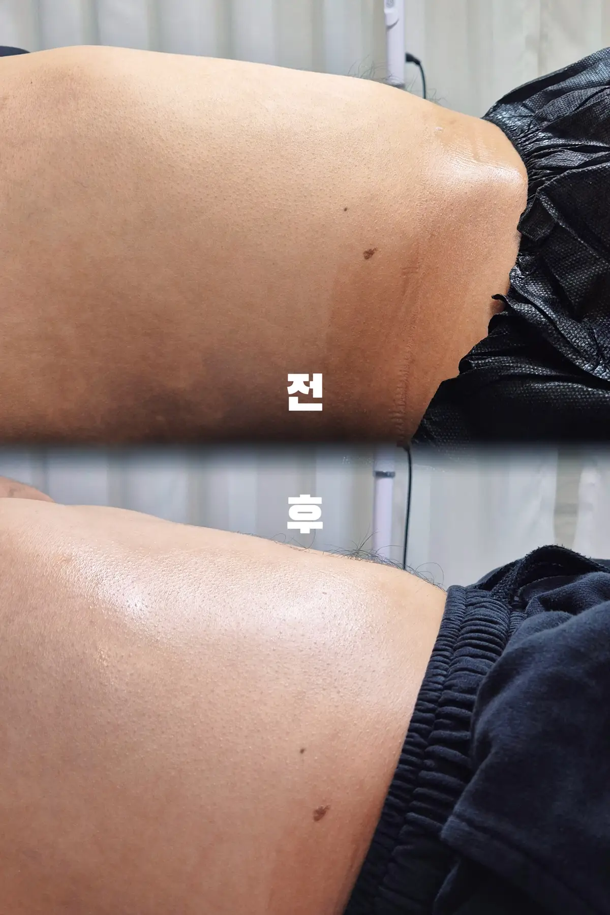 이미지 3