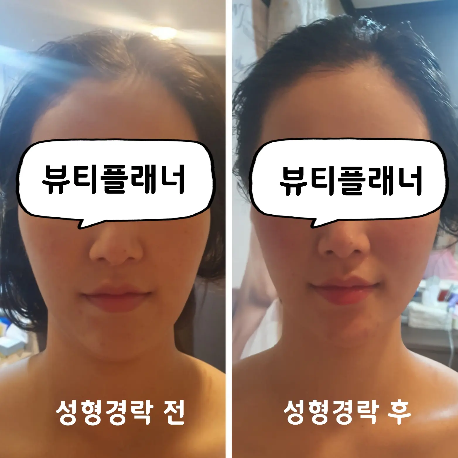 이미지 11