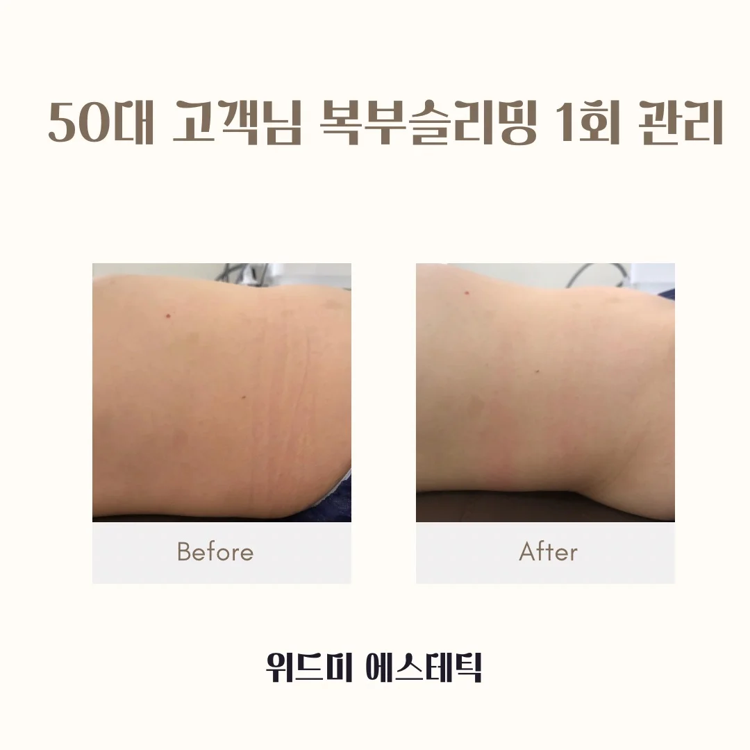이미지 4