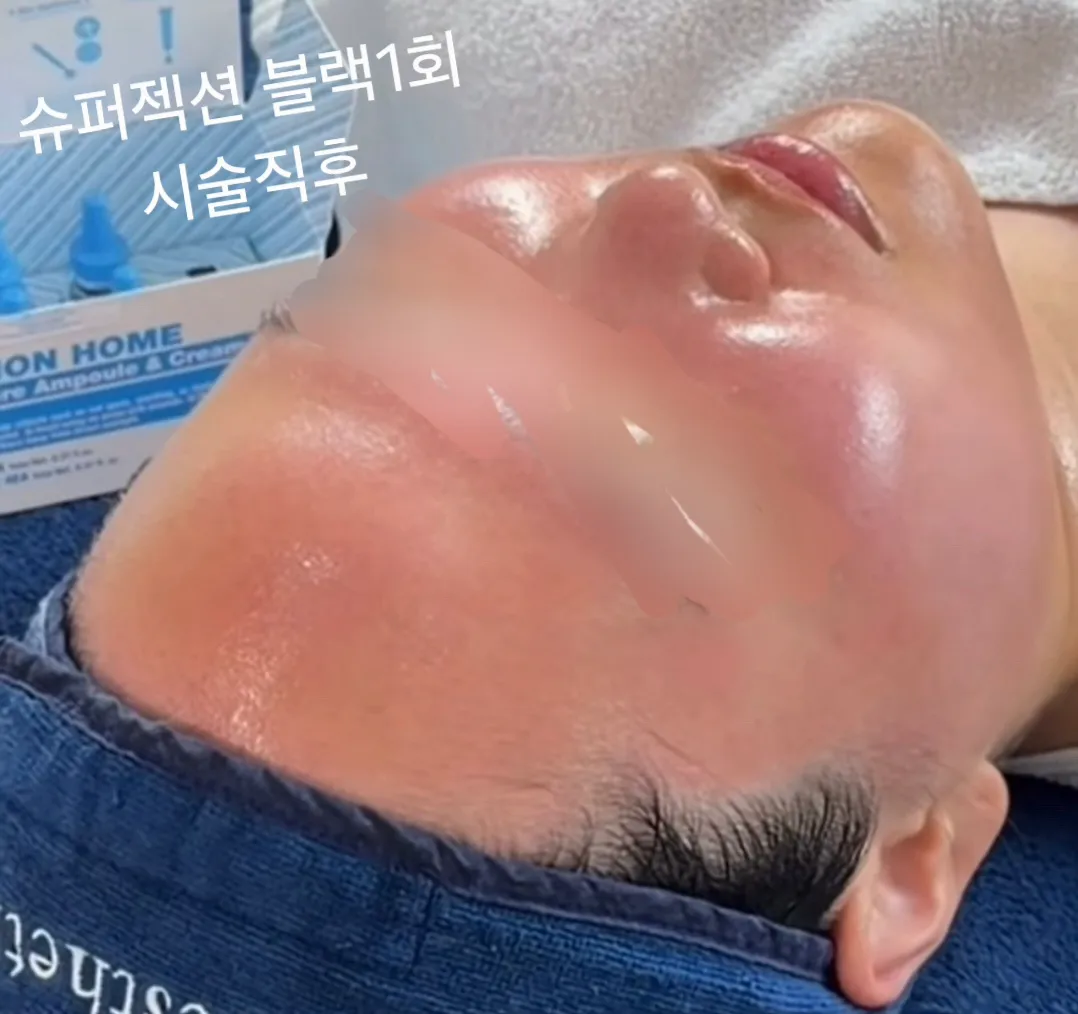 이미지 12