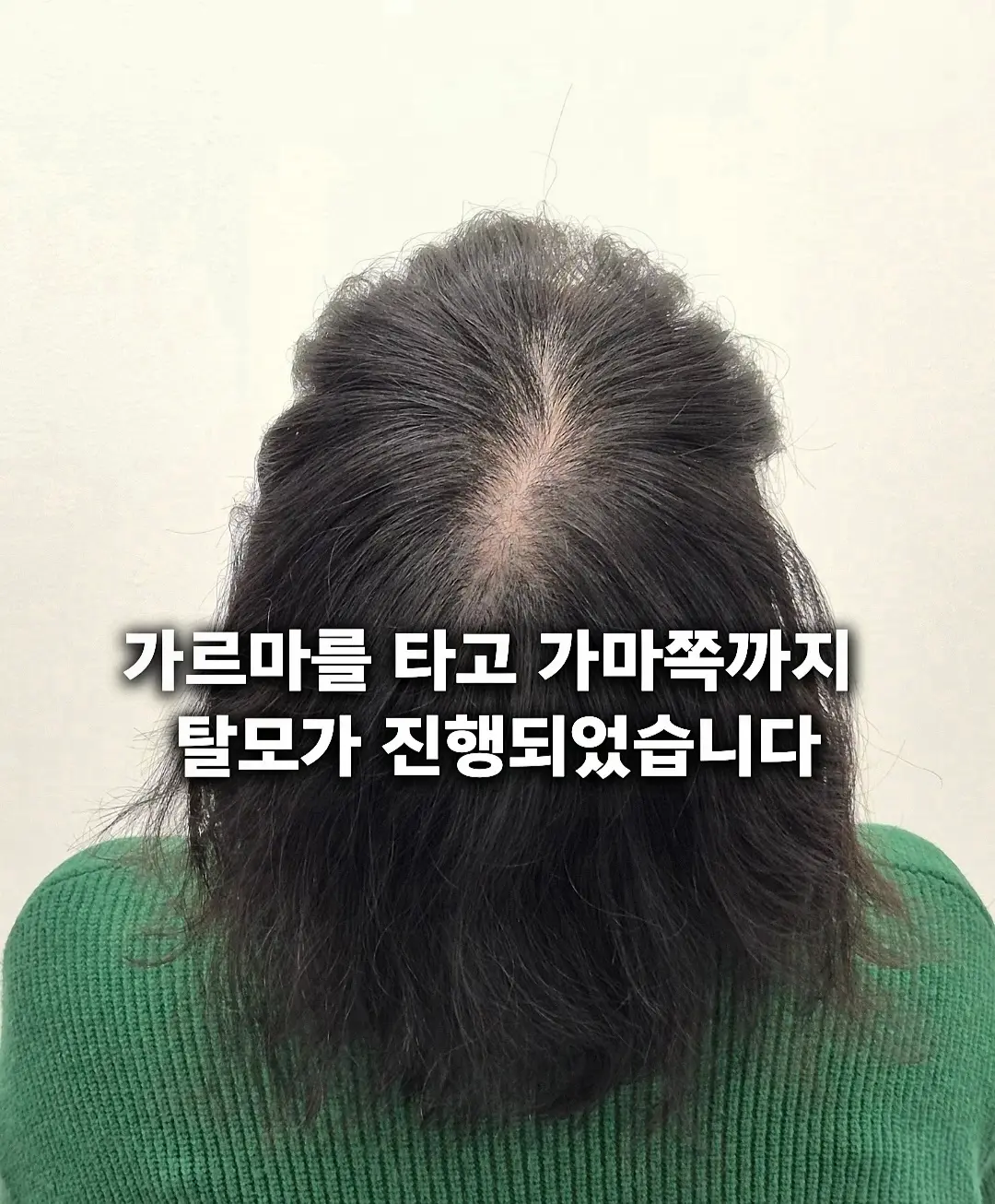이미지 7