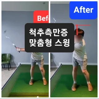 S자 척추측만증을 지니고 계신 회원님