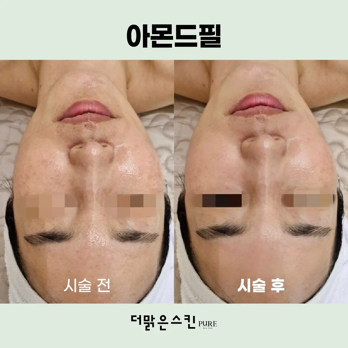 이미지 5