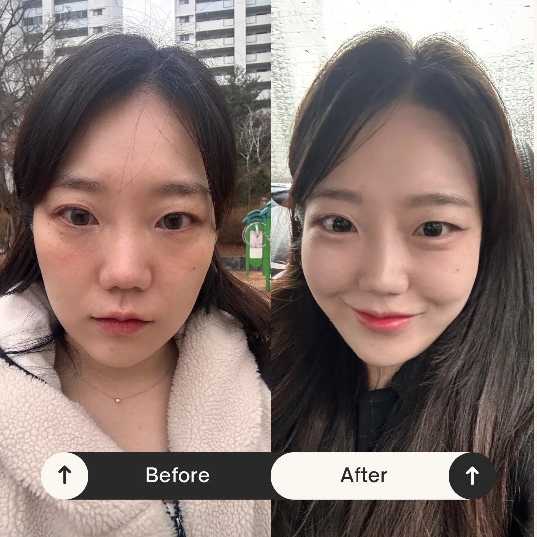 이미지 3