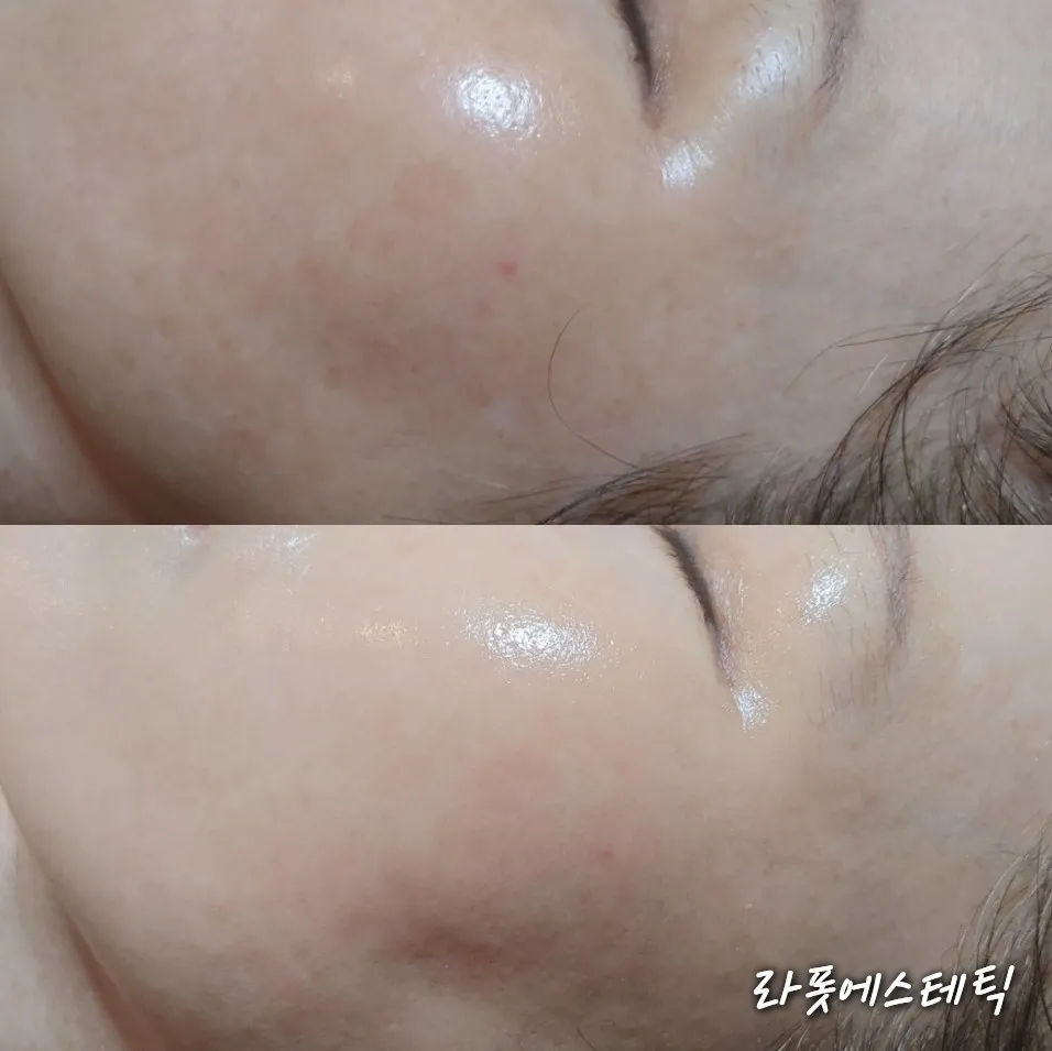 이미지 3
