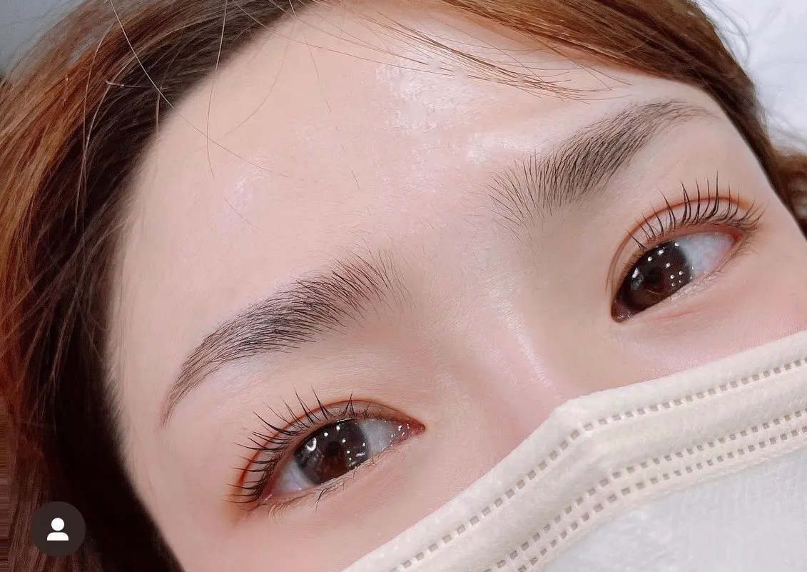 이미지 3
