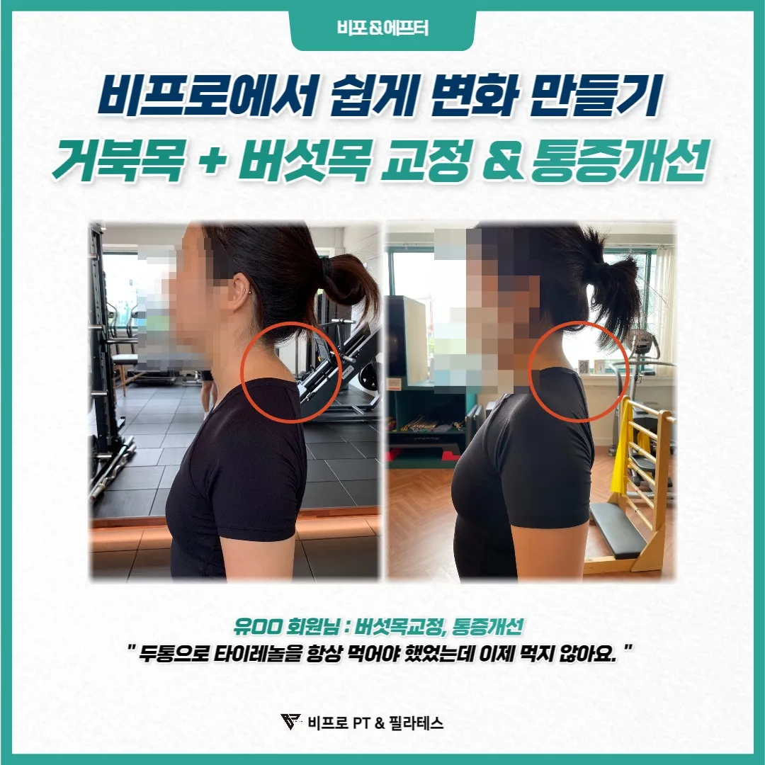 이미지 10