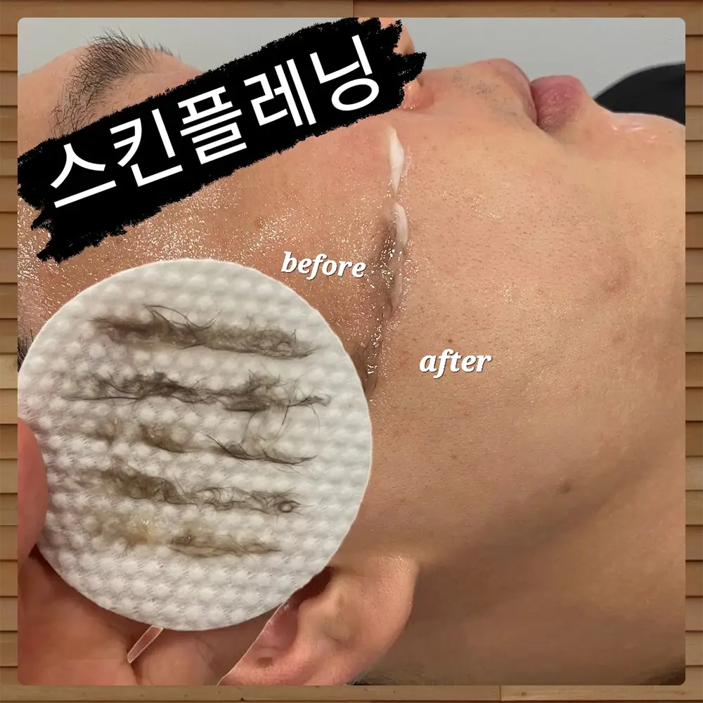 이미지 6