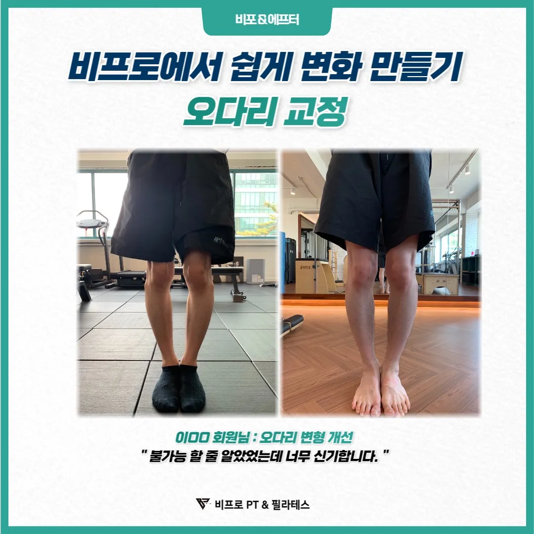 이미지 6
