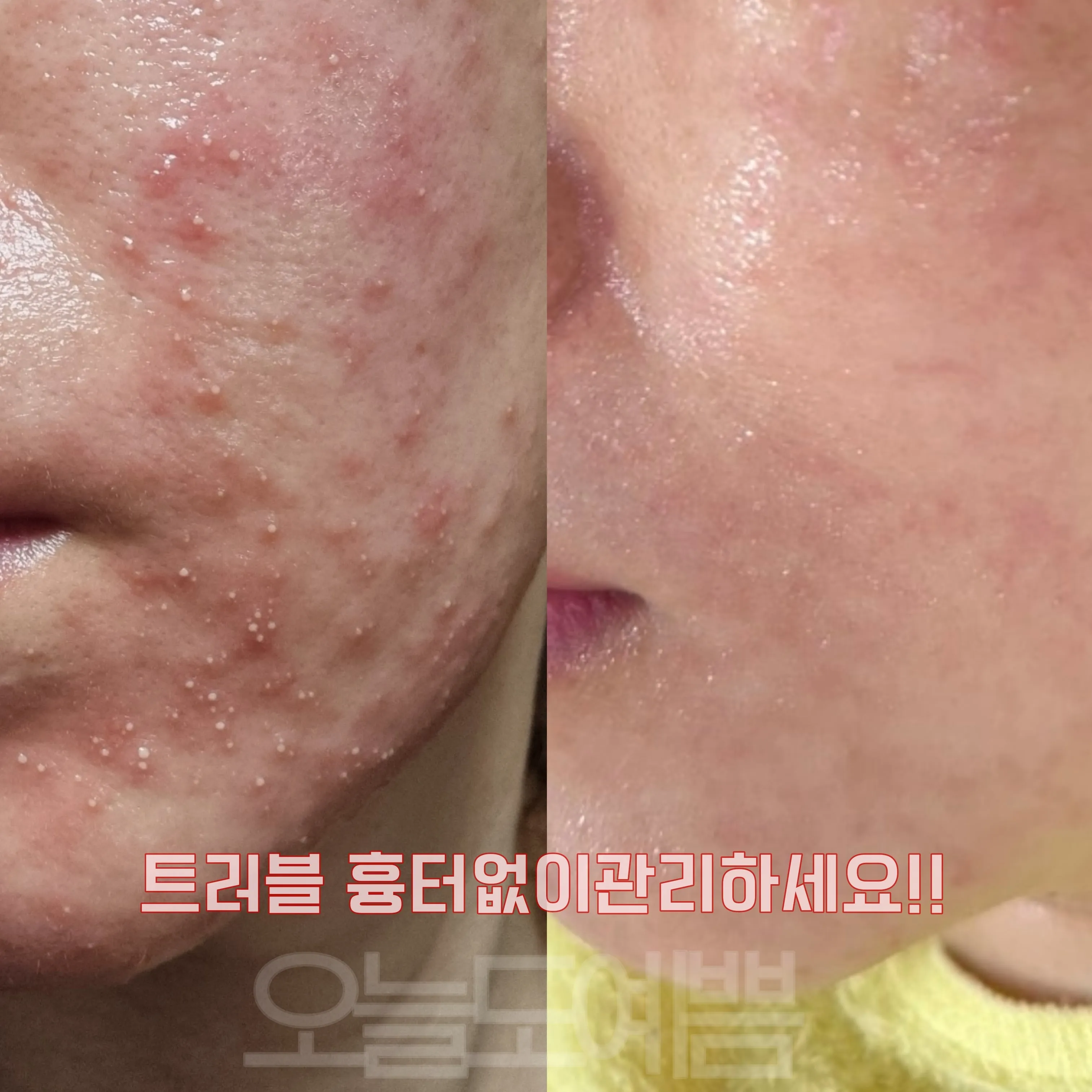 이미지 12