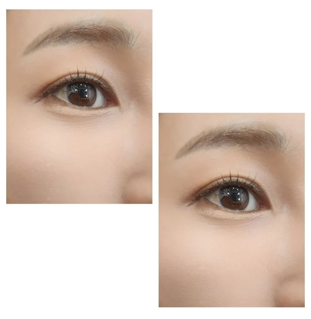 이미지 5
