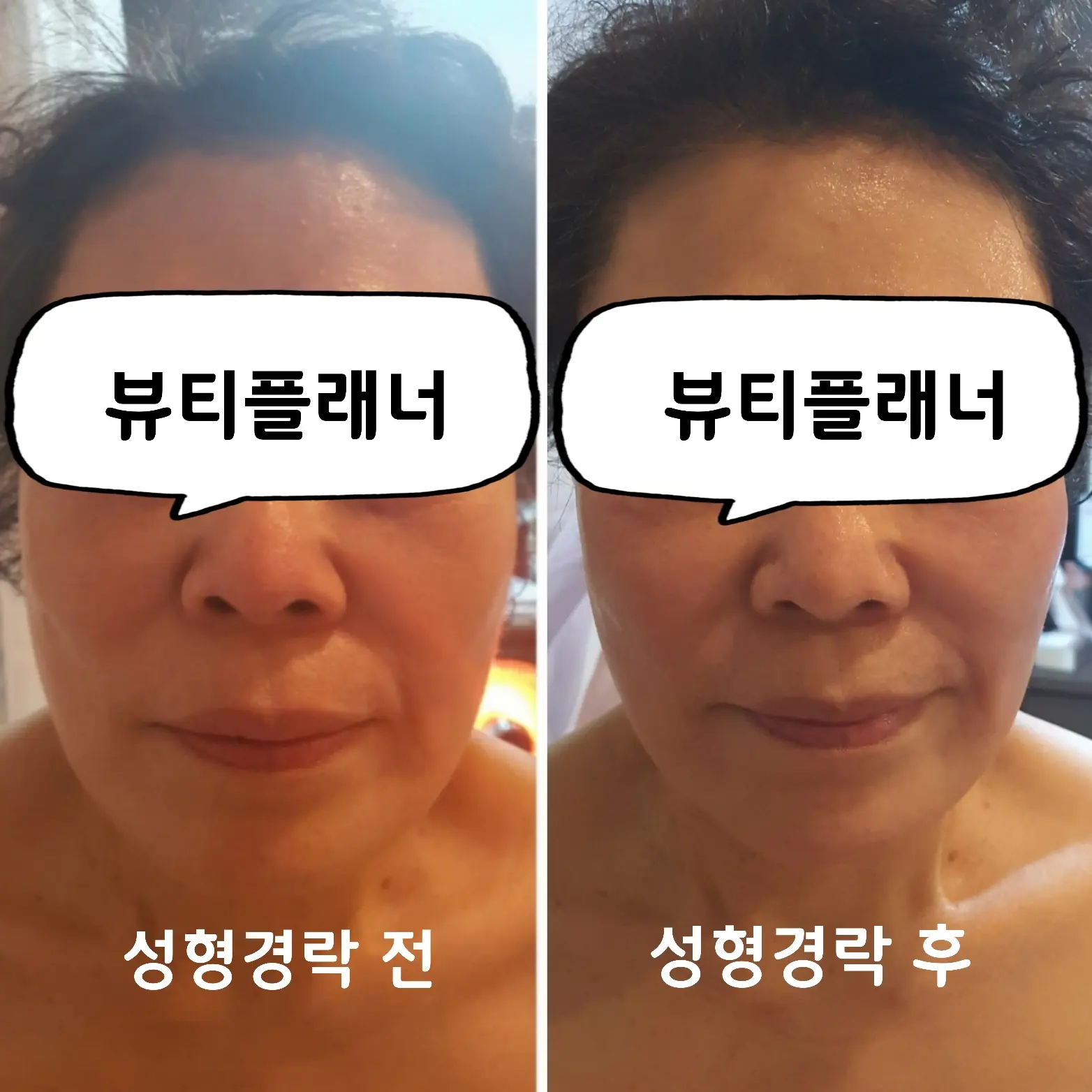 이미지 7