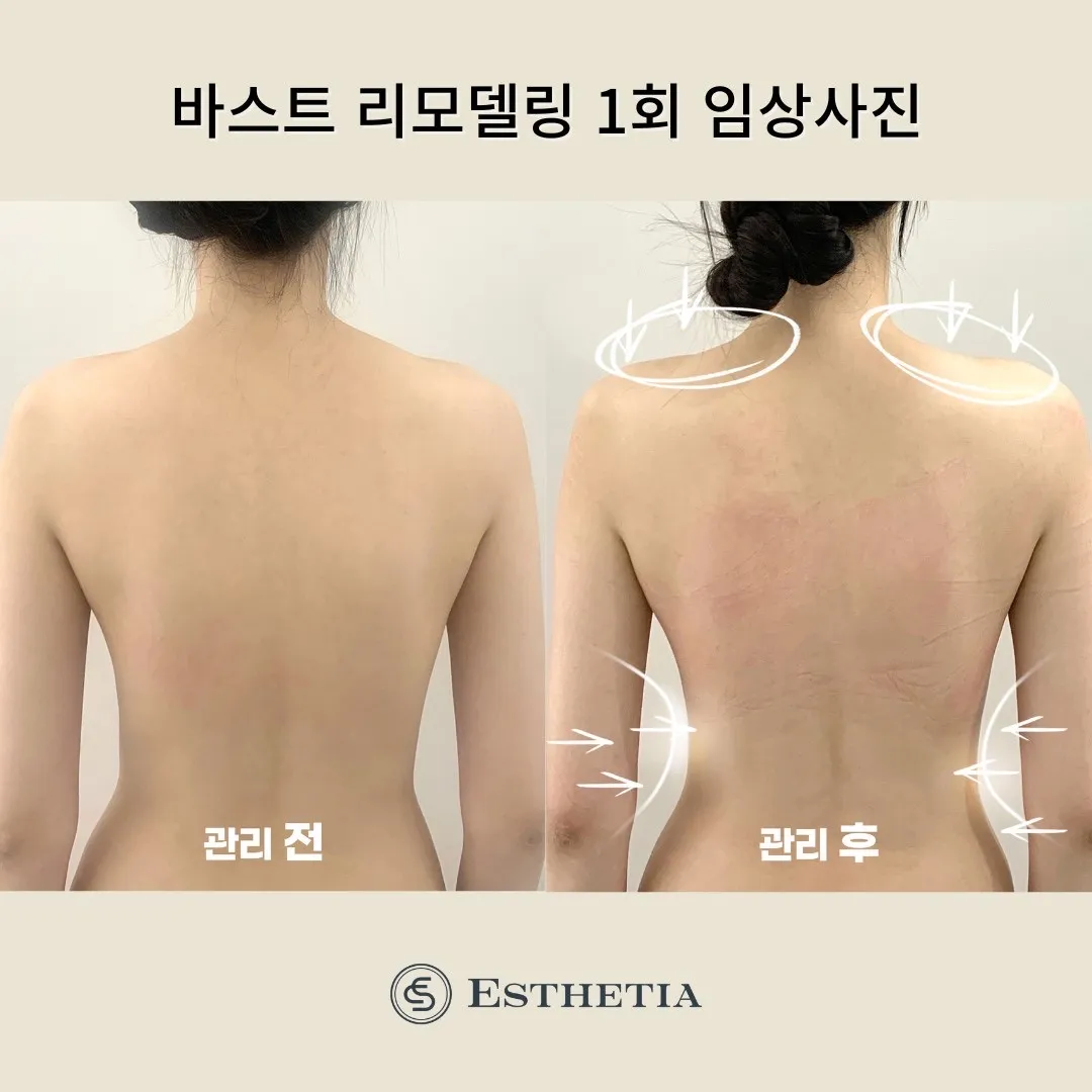 이미지 7