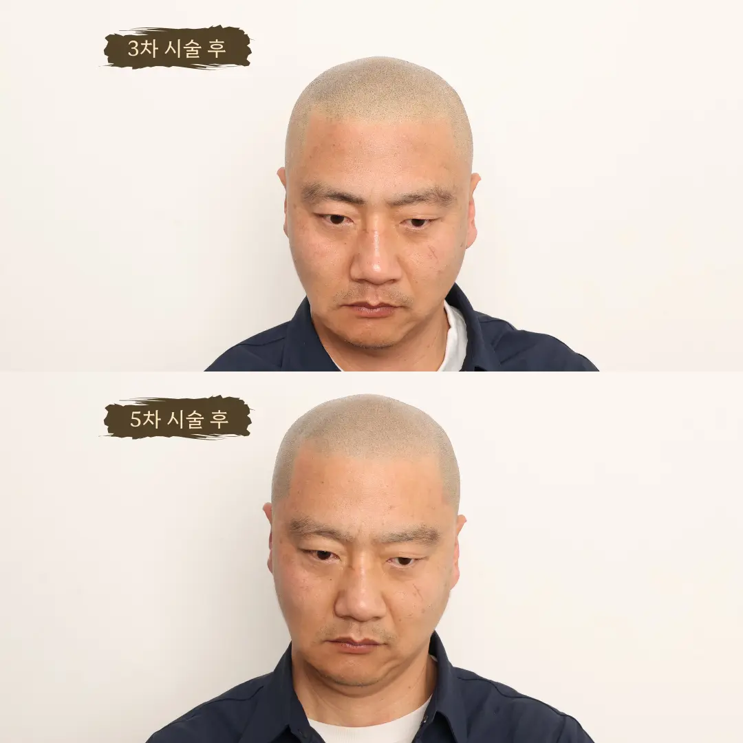 이미지 14