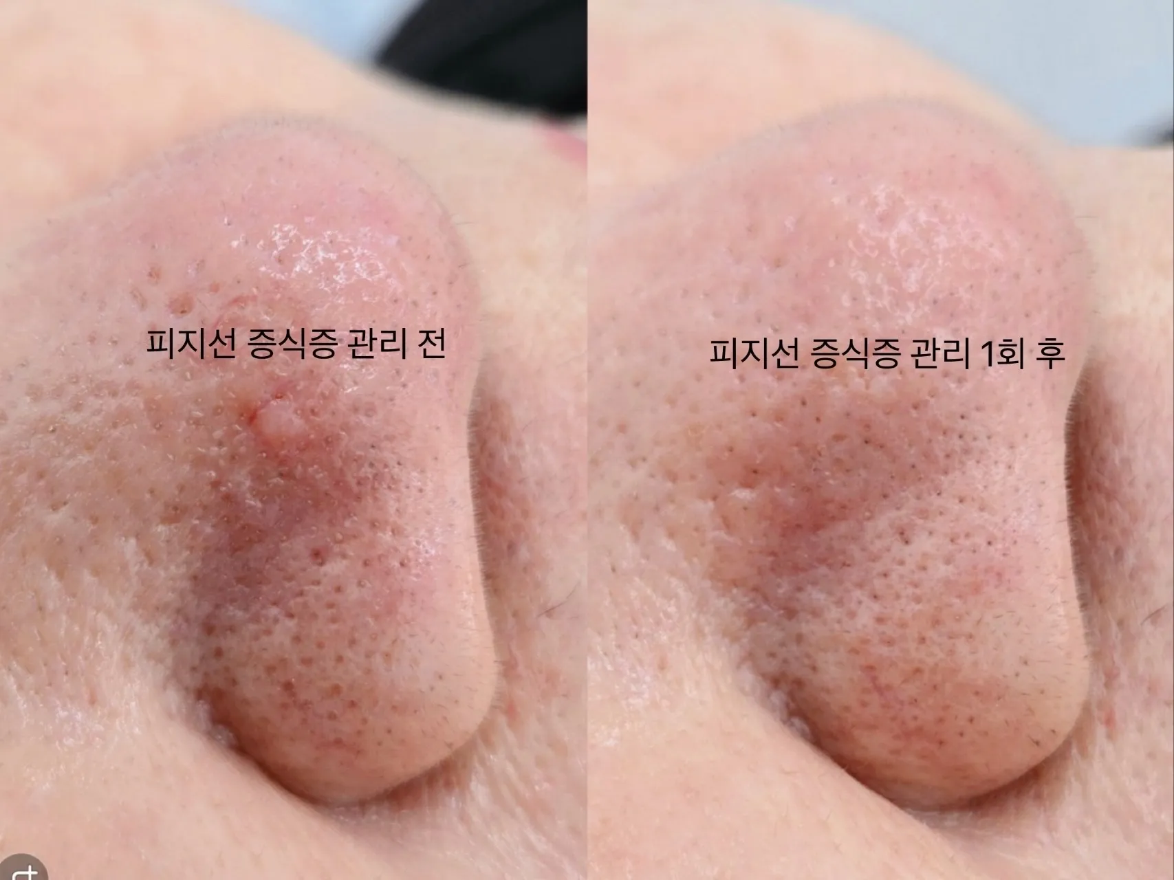 이미지 22