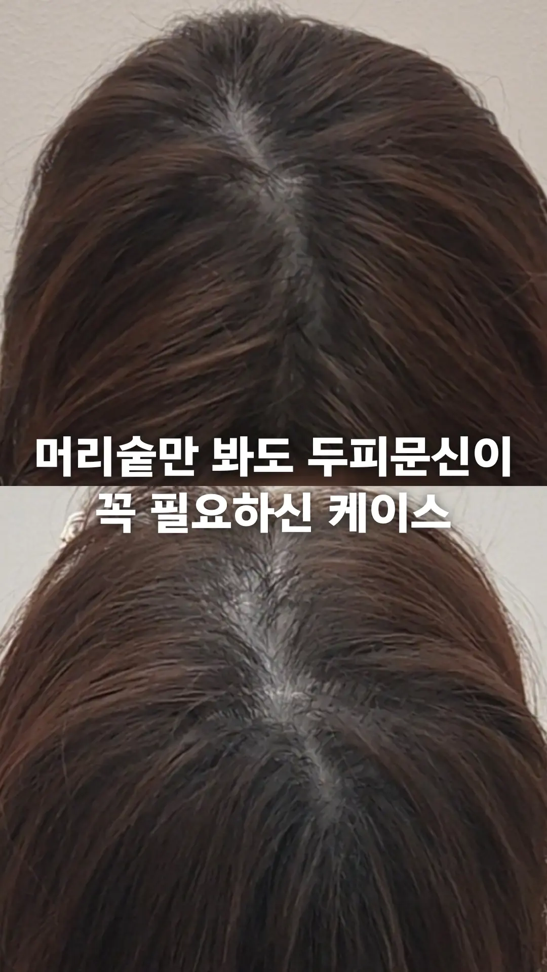 이미지 5