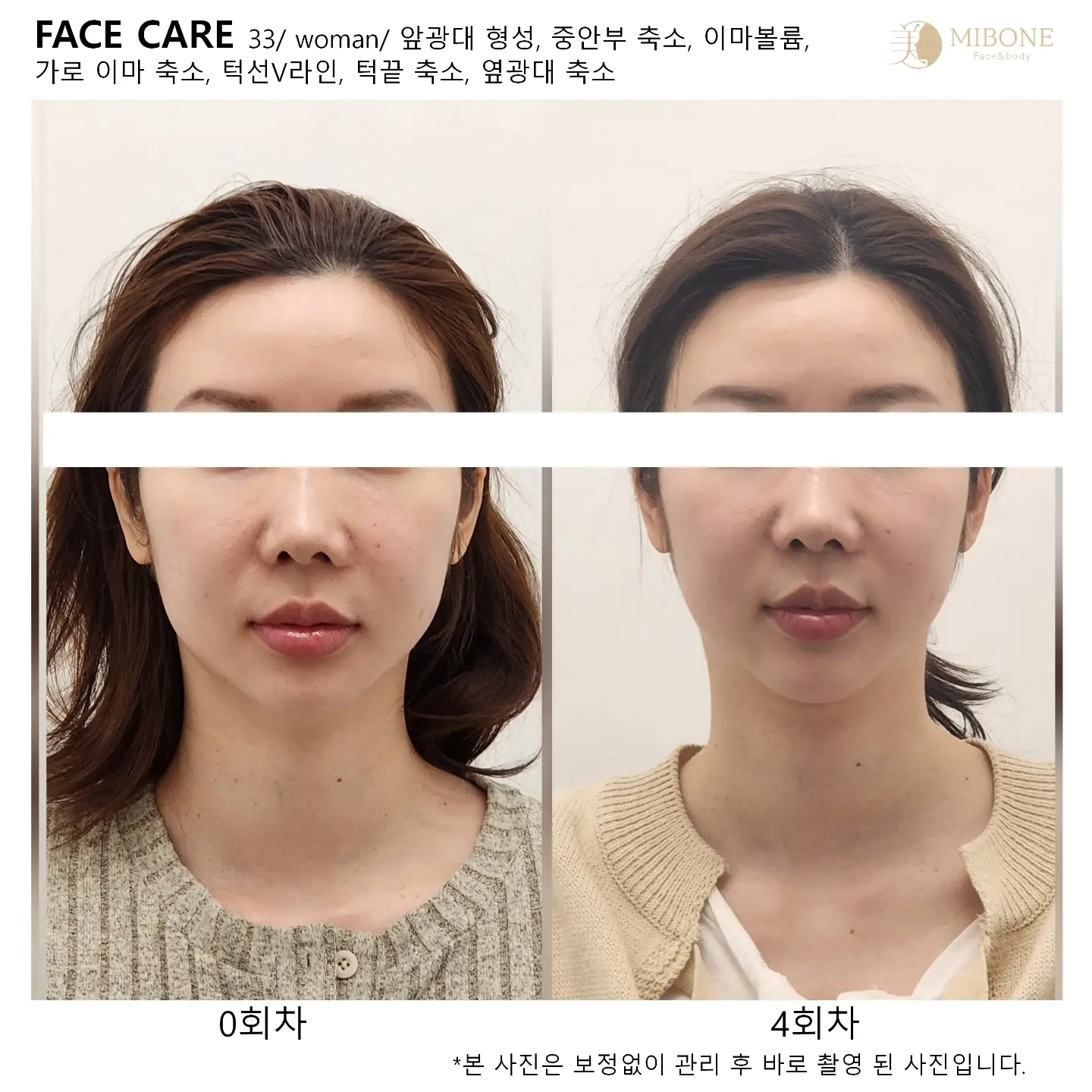 이미지 4