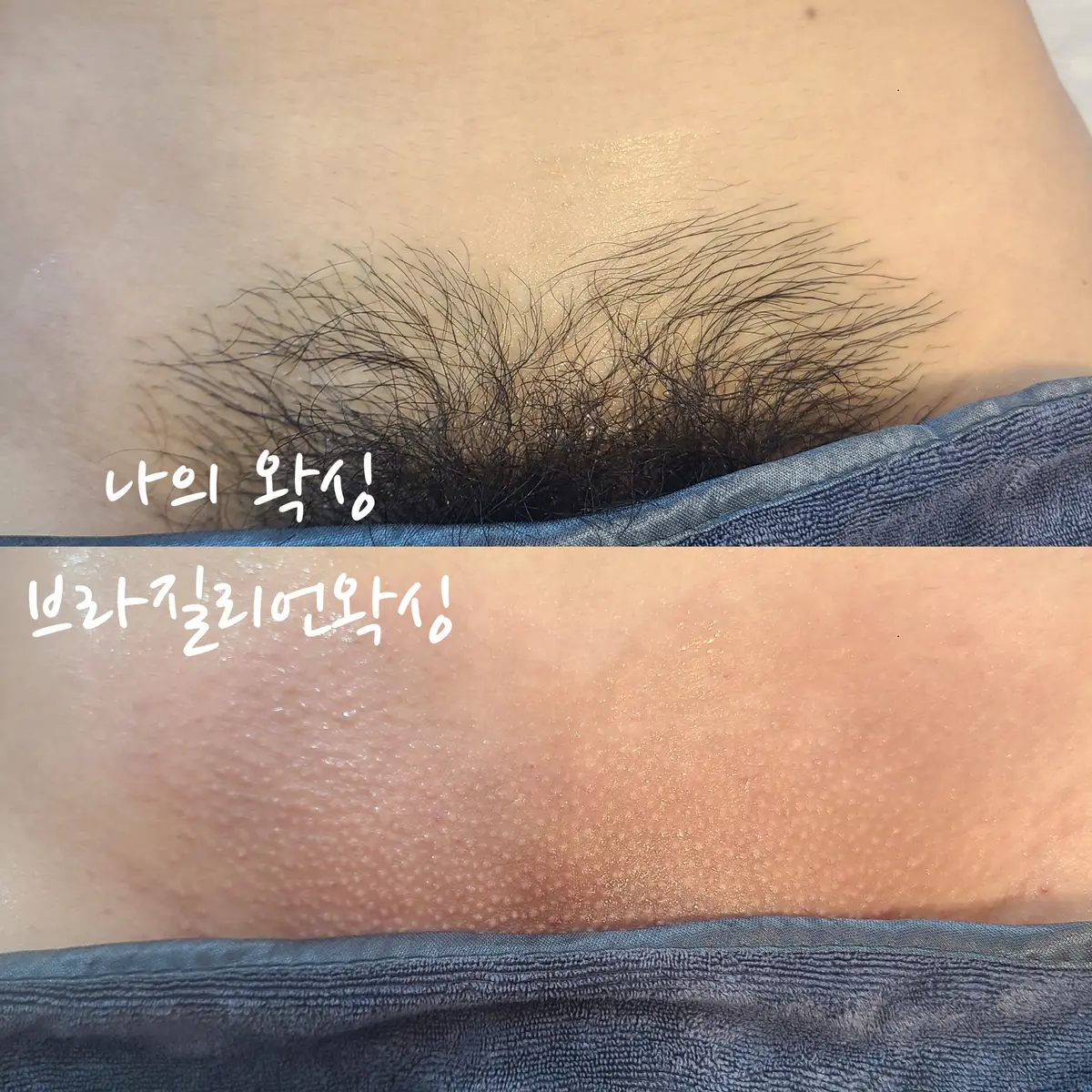 이미지 7