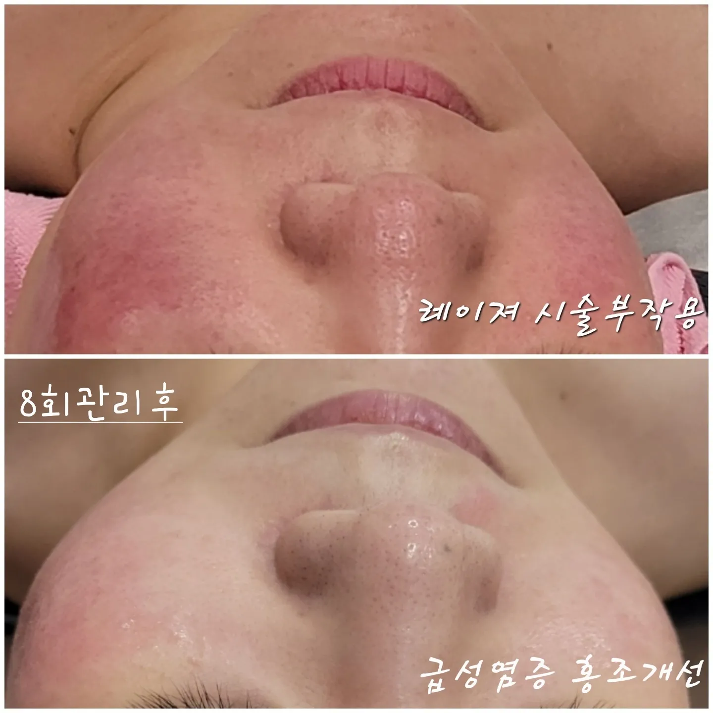 이미지 5