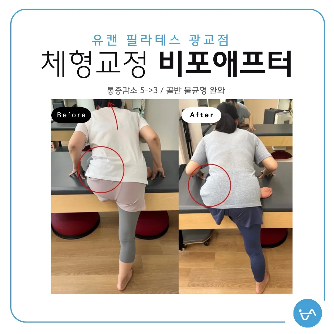 이미지 4